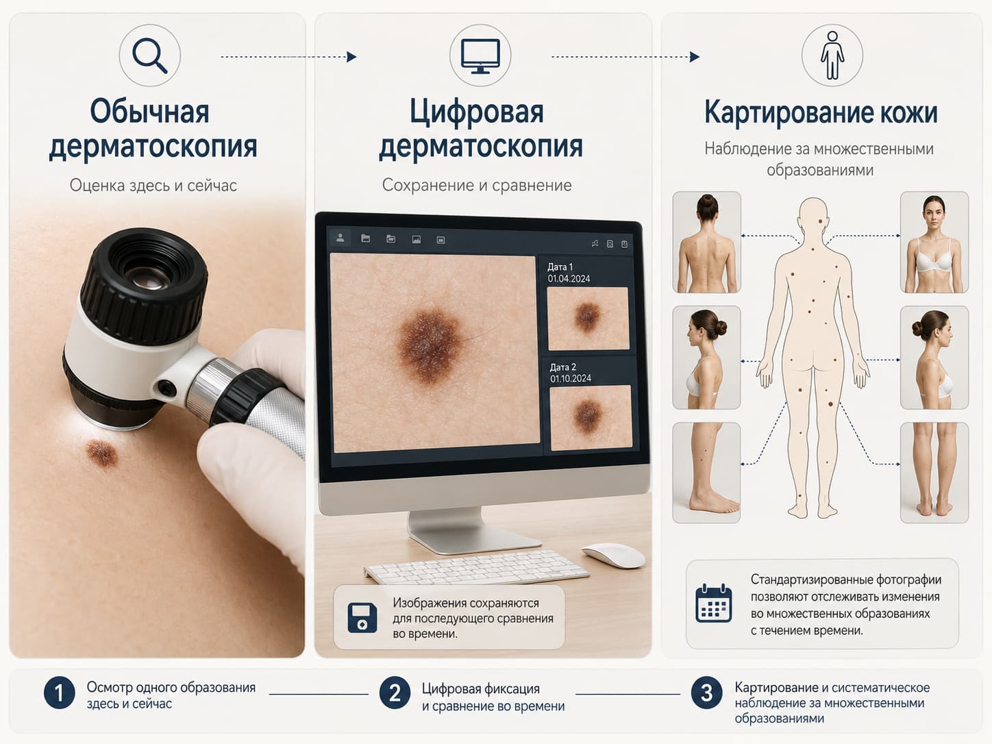Виды дерматоскопии и картирование родинок Сравнение обычной и цифровой дерматоскопии с картированием родинок на коже