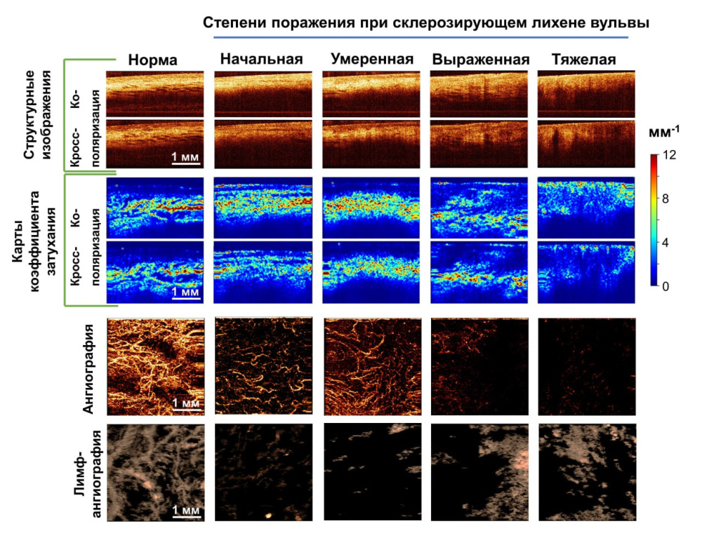 Учёные ПИМУ вместе с врачами проводят исследования нового метода диагностики опасной женской болезни