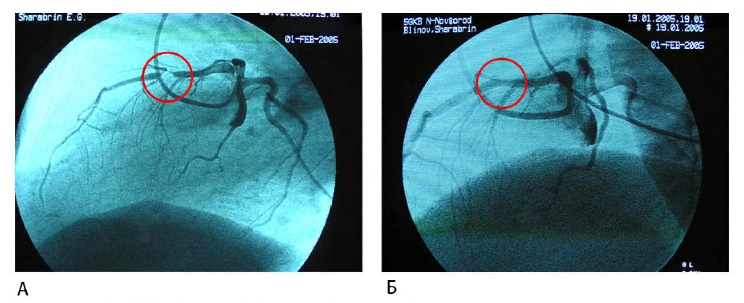 Онкологии, лучевой терапии и радиологии им. профессора Н.Е. Яхонтова