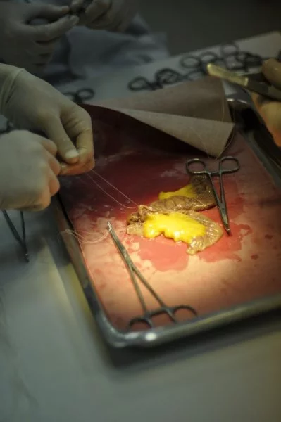 Общей хирургии им. А.И. Кожевникова